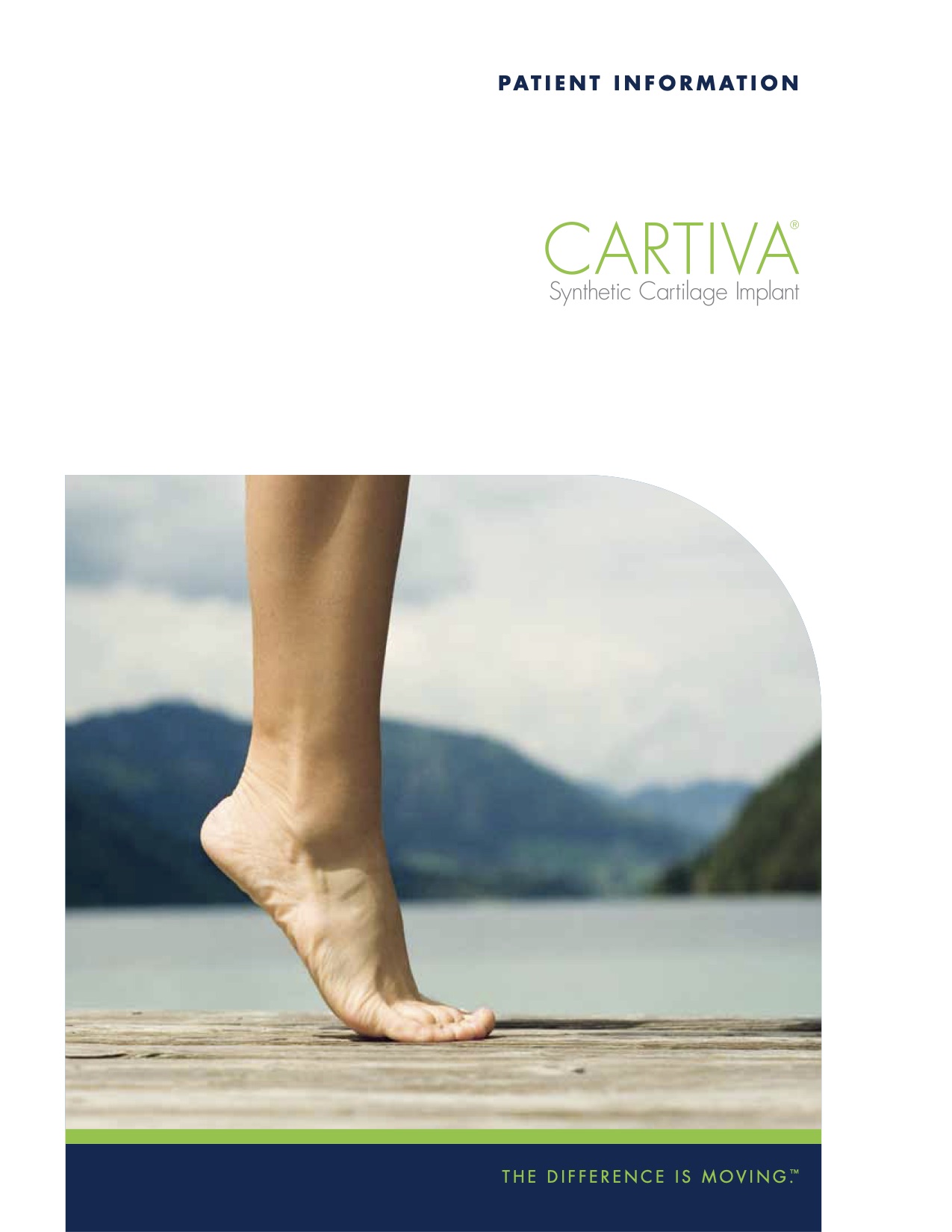 Cartiva Synthetic Cartilage Implant San Mateo Podiatry Group